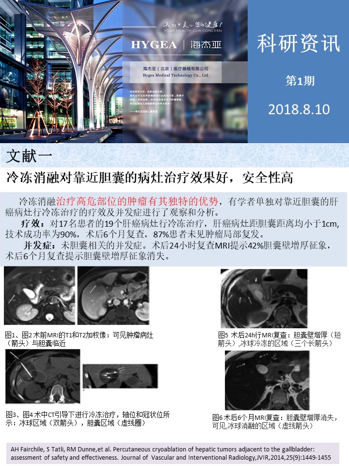 【海杰亞科研資訊】第1期——肝、肺癌消融